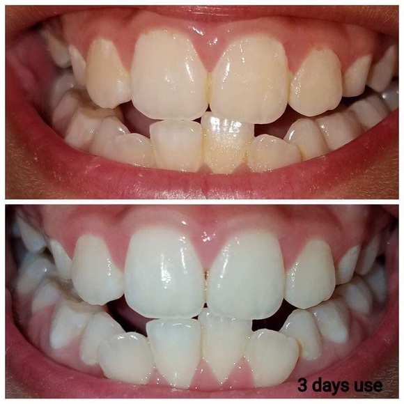 AP24 whitening toothpaste - Picture 4 of 7